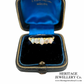 Antique Opal and Diamond 5-Stone Ring
